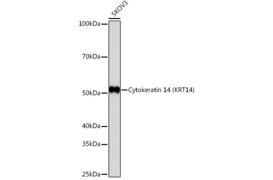 Western Blot - Anti-Cytokeratin 14 Antibody [ARC0351] (A309051) - Antibodies.com