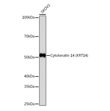 Western Blot - Anti-Cytokeratin 14 Antibody [ARC0351] (A309051) - Antibodies.com