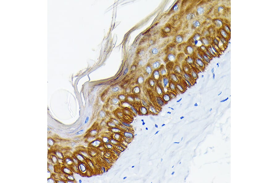 Immunohistochemistry - Anti-Cytokeratin 14 Antibody [ARC0351] (A309051) - Antibodies.com