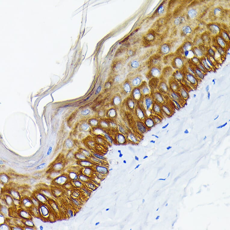 Immunohistochemistry - Anti-Cytokeratin 14 Antibody [ARC0351] (A309051) - Antibodies.com