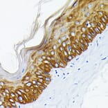 Immunohistochemistry - Anti-Cytokeratin 14 Antibody [ARC0351] (A309051) - Antibodies.com