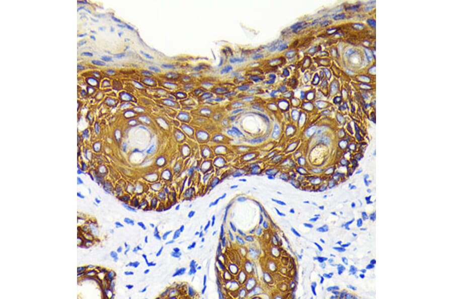 Immunohistochemistry - Anti-Cytokeratin 14 Antibody [ARC0351] (A309051) - Antibodies.com