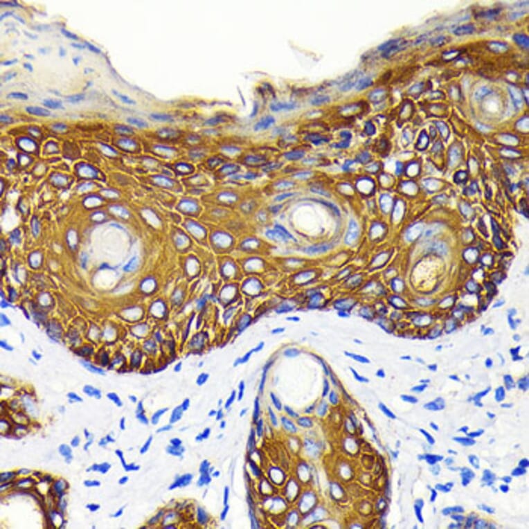 Immunohistochemistry - Anti-Cytokeratin 14 Antibody [ARC0351] (A309051) - Antibodies.com