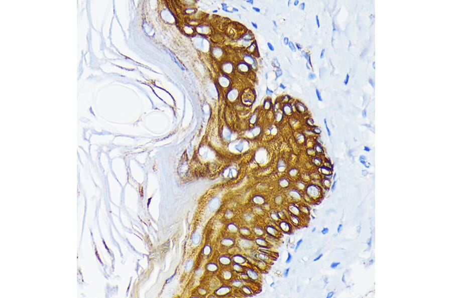 Immunohistochemistry - Anti-Cytokeratin 14 Antibody [ARC0351] (A309051) - Antibodies.com