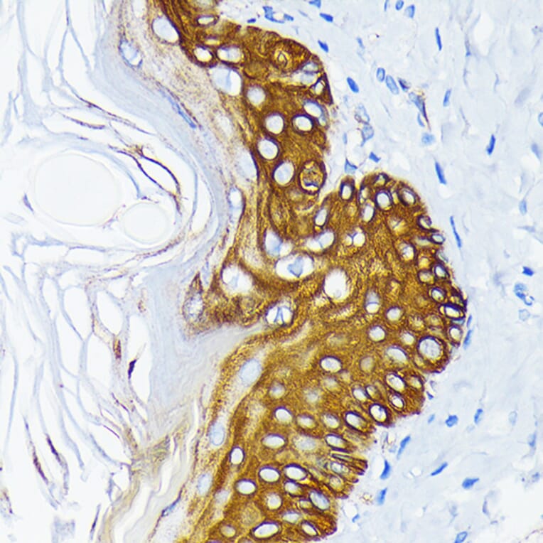 Immunohistochemistry - Anti-Cytokeratin 14 Antibody [ARC0351] (A309051) - Antibodies.com
