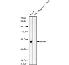 Western Blot - Anti-ALDH1A1 Antibody [ARC52435] (A309052) - Antibodies.com