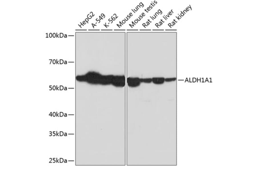 Western Blot - Anti-ALDH1A1 Antibody [ARC52440] (A309053) - Antibodies.com