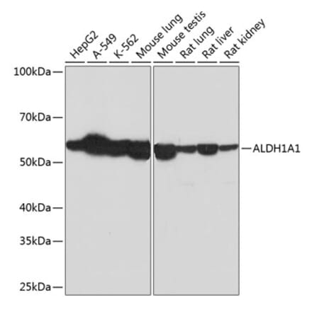 Western Blot - Anti-ALDH1A1 Antibody [ARC52440] (A309053) - Antibodies.com