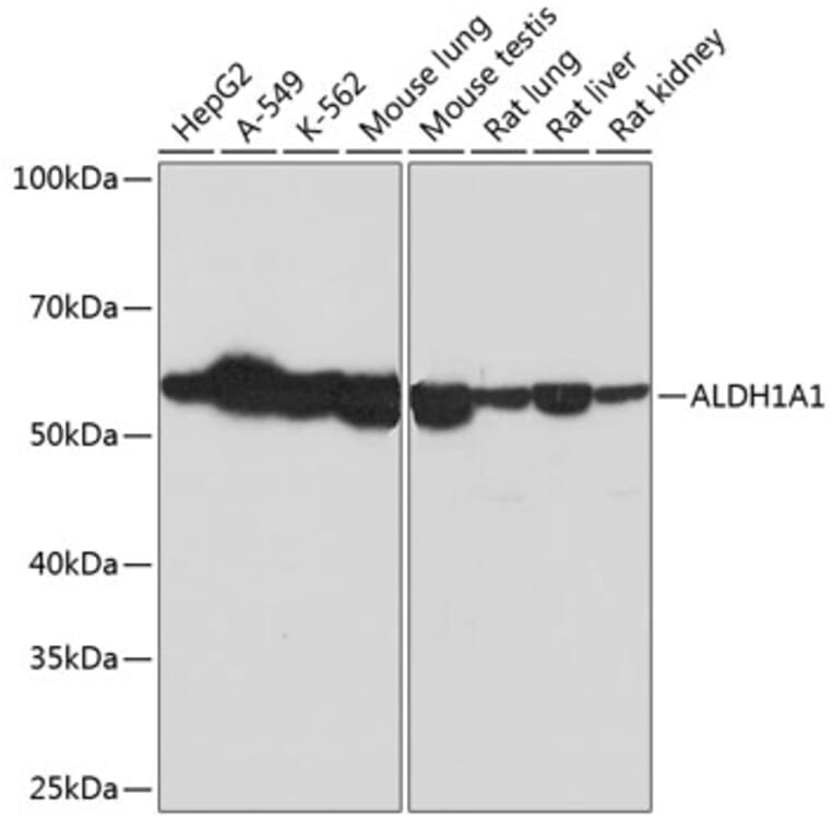 Western Blot - Anti-ALDH1A1 Antibody [ARC52440] (A309053) - Antibodies.com