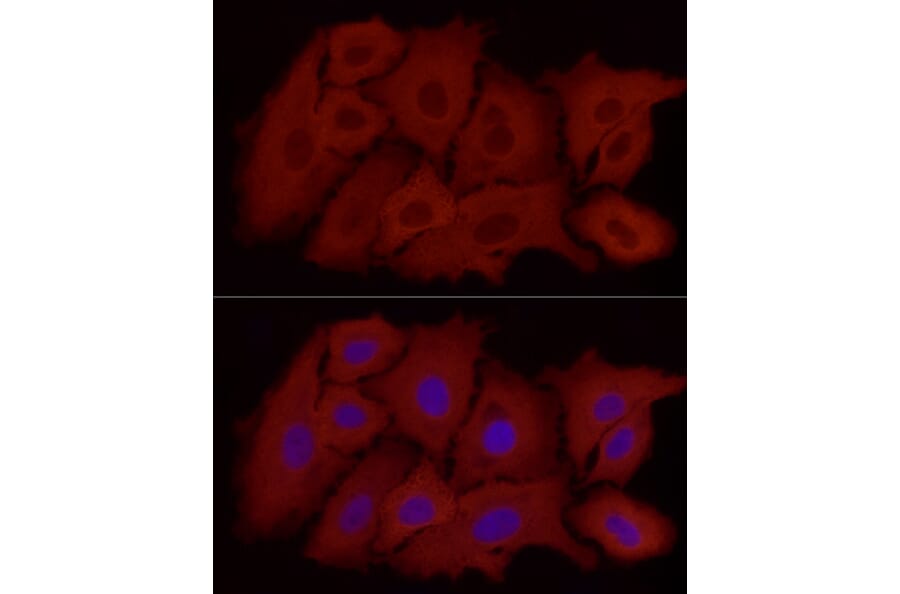 Immunofluorescence - Anti-ALDH1A1 Antibody [ARC52440] (A309053) - Antibodies.com