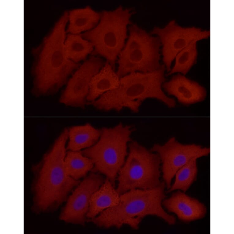 Immunofluorescence - Anti-ALDH1A1 Antibody [ARC52440] (A309053) - Antibodies.com