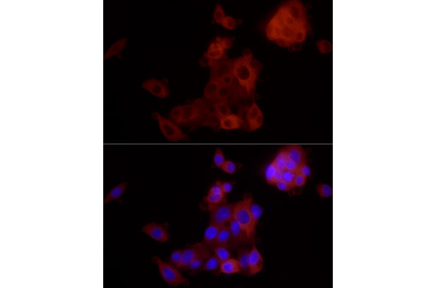 Immunofluorescence - Anti-ALDH1A1 Antibody [ARC52440] (A309053) - Antibodies.com