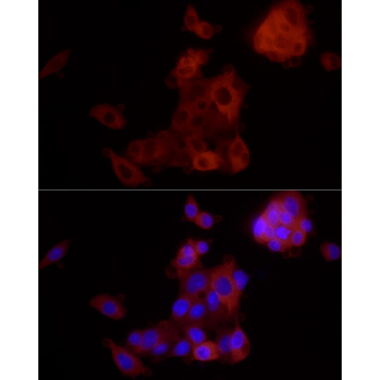 Immunofluorescence - Anti-ALDH1A1 Antibody [ARC52440] (A309053) - Antibodies.com