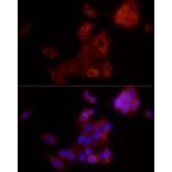 Immunofluorescence - Anti-ALDH1A1 Antibody [ARC52440] (A309053) - Antibodies.com