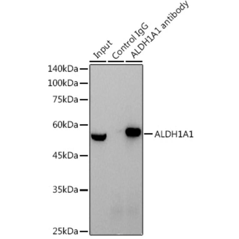 Western Blot - Anti-ALDH1A1 Antibody [ARC52440] (A309053) - Antibodies.com