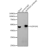 Western Blot - Anti-ALDH1A1 Antibody [ARC52440] (A309053) - Antibodies.com