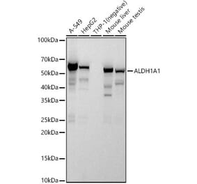 Western Blot - Anti-ALDH1A1 Antibody [ARC52440 + ARC52441] (A309054) - Antibodies.com