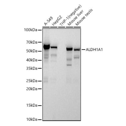 Western Blot - Anti-ALDH1A1 Antibody [ARC52440 + ARC52441] (A309054) - Antibodies.com