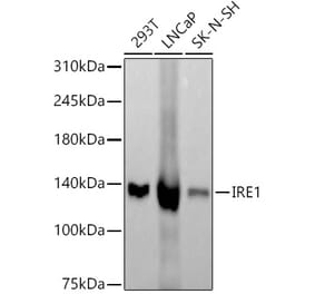 Western Blot - Anti-IRE1 Antibody [ARC57190] (A309055) - Antibodies.com