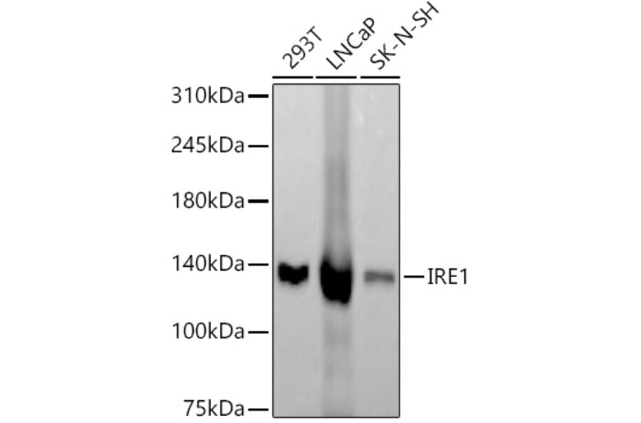 Western Blot - Anti-IRE1 Antibody [ARC57190] (A309055) - Antibodies.com