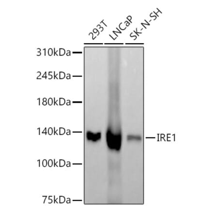 Western Blot - Anti-IRE1 Antibody [ARC57190] (A309055) - Antibodies.com