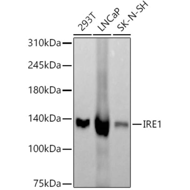 Western Blot - Anti-IRE1 Antibody [ARC57190] (A309055) - Antibodies.com