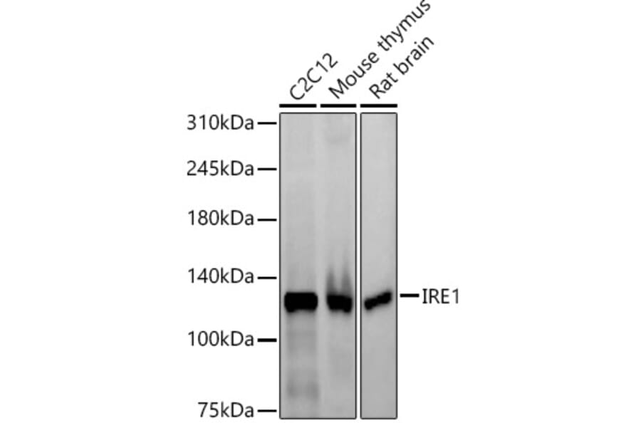 Western Blot - Anti-IRE1 Antibody [ARC57190] (A309055) - Antibodies.com
