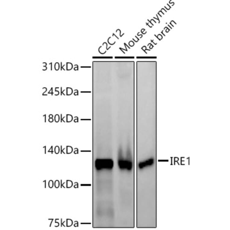 Western Blot - Anti-IRE1 Antibody [ARC57190] (A309055) - Antibodies.com