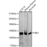 Western Blot - Anti-IRE1 Antibody [ARC57190] (A309055) - Antibodies.com