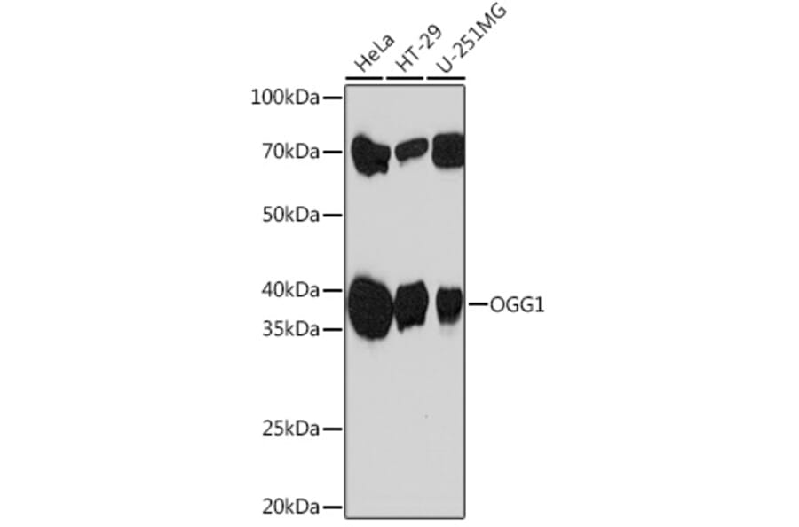 Western Blot - Anti-Ogg1 Antibody [ARC1233] (A309056) - Antibodies.com