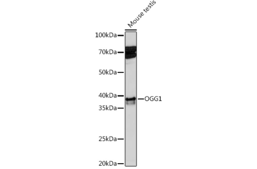 Western Blot - Anti-Ogg1 Antibody [ARC1233] (A309056) - Antibodies.com
