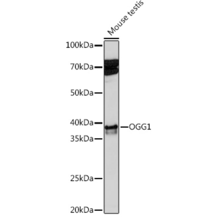 Western Blot - Anti-Ogg1 Antibody [ARC1233] (A309056) - Antibodies.com