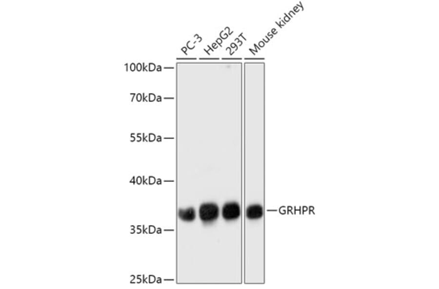 Western Blot - Anti-GRHPR Antibody (A309057) - Antibodies.com