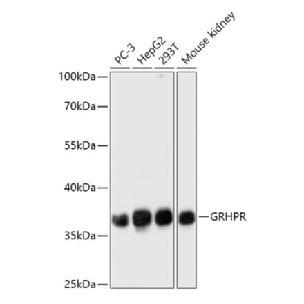Western Blot - Anti-GRHPR Antibody (A309057) - Antibodies.com