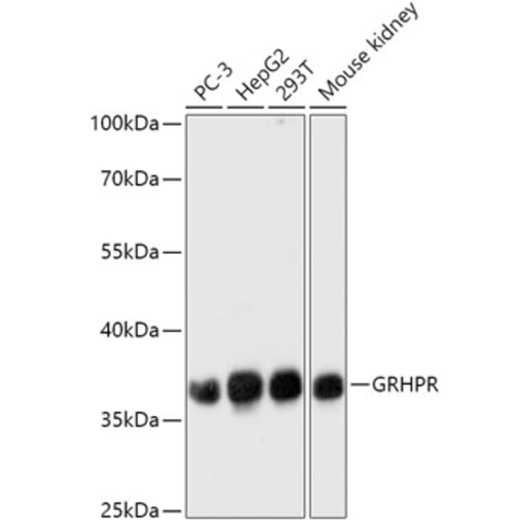 Western Blot - Anti-GRHPR Antibody (A309057) - Antibodies.com