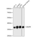 Western Blot - Anti-GRHPR Antibody (A309057) - Antibodies.com