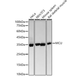Western Blot - Anti-MCU Antibody [ARC57879] (A309059) - Antibodies.com