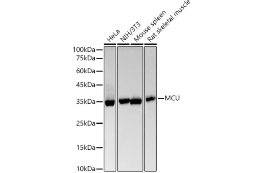 Western Blot - Anti-MCU Antibody [ARC57879] (A309059) - Antibodies.com