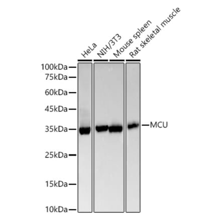 Western Blot - Anti-MCU Antibody [ARC57879] (A309059) - Antibodies.com