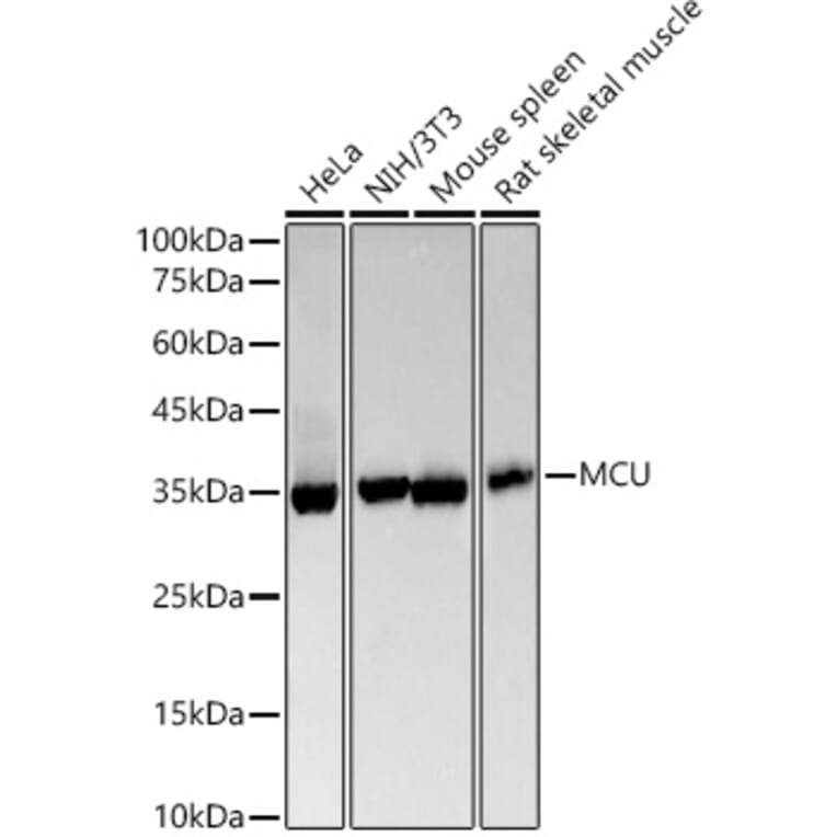 Western Blot - Anti-MCU Antibody [ARC57879] (A309059) - Antibodies.com