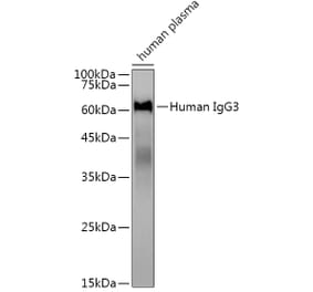 Western Blot - Anti-Human IgG Antibody [ARC2243] (A309060) - Antibodies.com