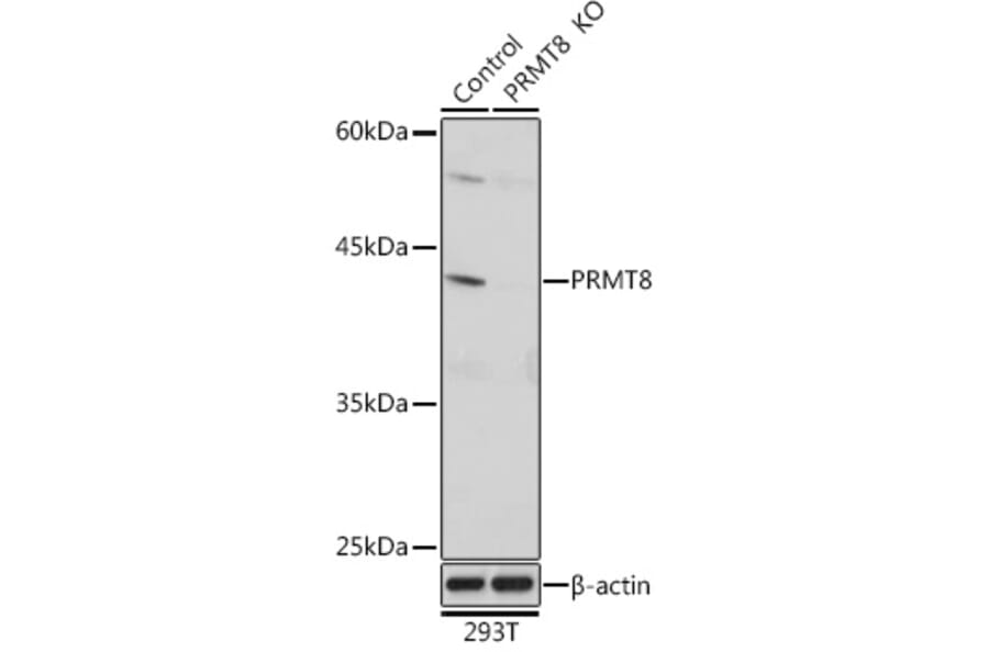 Western Blot - Anti-PRMT8 Antibody (A309061) - Antibodies.com