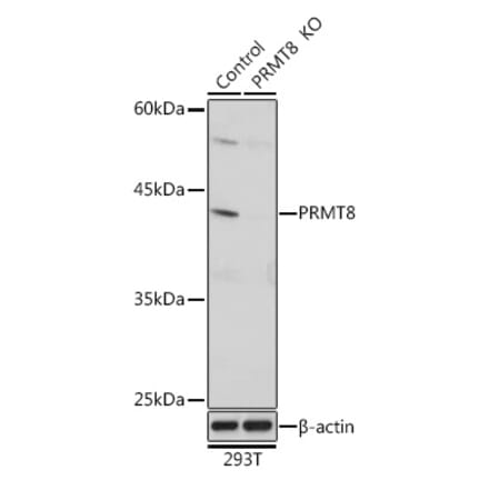 Western Blot - Anti-PRMT8 Antibody (A309061) - Antibodies.com