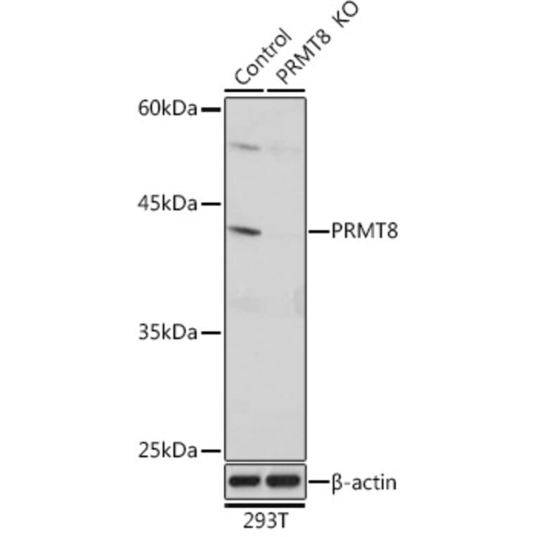 Western Blot - Anti-PRMT8 Antibody (A309061) - Antibodies.com