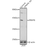 Western Blot - Anti-PRMT8 Antibody (A309061) - Antibodies.com