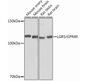Western Blot - Anti-LGR5 Antibody [ARC0321] (A309062) - Antibodies.com