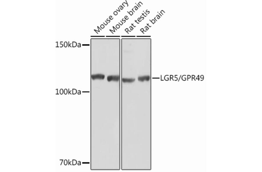 Western Blot - Anti-LGR5 Antibody [ARC0321] (A309062) - Antibodies.com