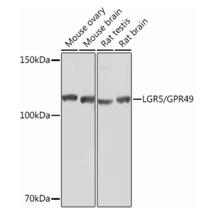 Western Blot - Anti-LGR5 Antibody [ARC0321] (A309062) - Antibodies.com