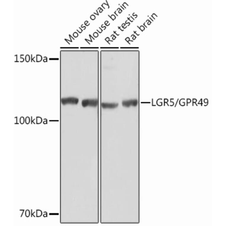 Western Blot - Anti-LGR5 Antibody [ARC0321] (A309062) - Antibodies.com
