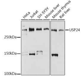 Western Blot - Anti-USP24 Antibody [ARC2526] (A309063) - Antibodies.com